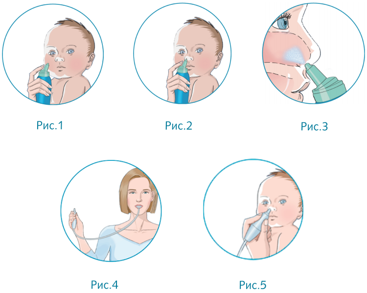 Как правильно делать туалет носа новорожденному ребенку